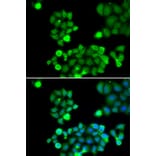 Immunofluorescence - NEIL1 antibody from Signalway Antibody (38695) - Antibodies.com