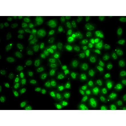 Immunofluorescence - PRMT2 antibody from Signalway Antibody (38696) - Antibodies.com