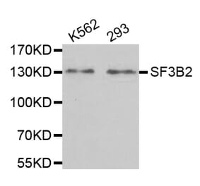 Western blot - SF3B2 antibody from Signalway Antibody (38701) - Antibodies.com