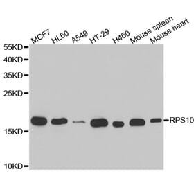 Western blot - RPS10 antibody from Signalway Antibody (38705) - Antibodies.com