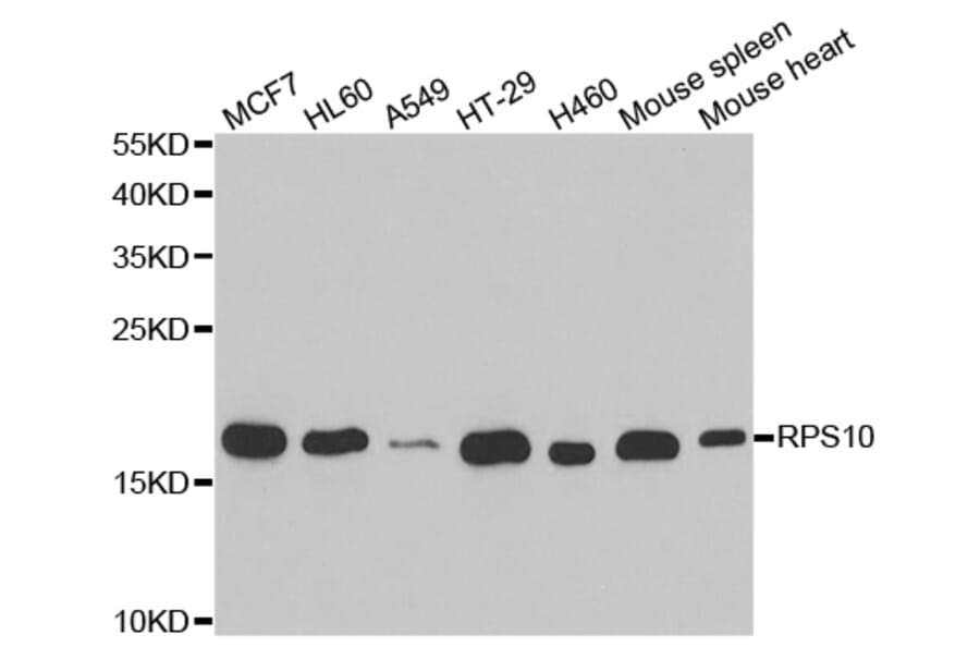 Western blot - RPS10 antibody from Signalway Antibody (38705) - Antibodies.com