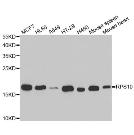 Western blot - RPS10 antibody from Signalway Antibody (38705) - Antibodies.com