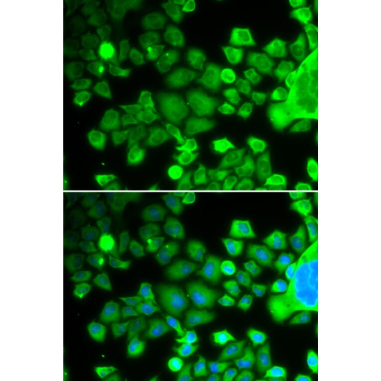 Immunofluorescence - RPS10 antibody from Signalway Antibody (38705) - Antibodies.com