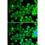 Immunofluorescence - RPS10 antibody from Signalway Antibody (38705) - Antibodies.com