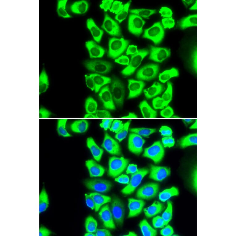 Immunofluorescence - RPS3A antibody from Signalway Antibody (38708) - Antibodies.com