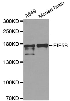 Western blot analysis of extracts of various cell lines, using EIF5B antibody.