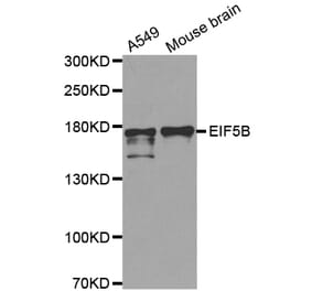 Western blot - EIF5B antibody from Signalway Antibody (38709) - Antibodies.com