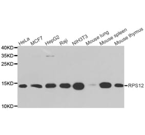 Western blot - RPS12 antibody from Signalway Antibody (38711) - Antibodies.com
