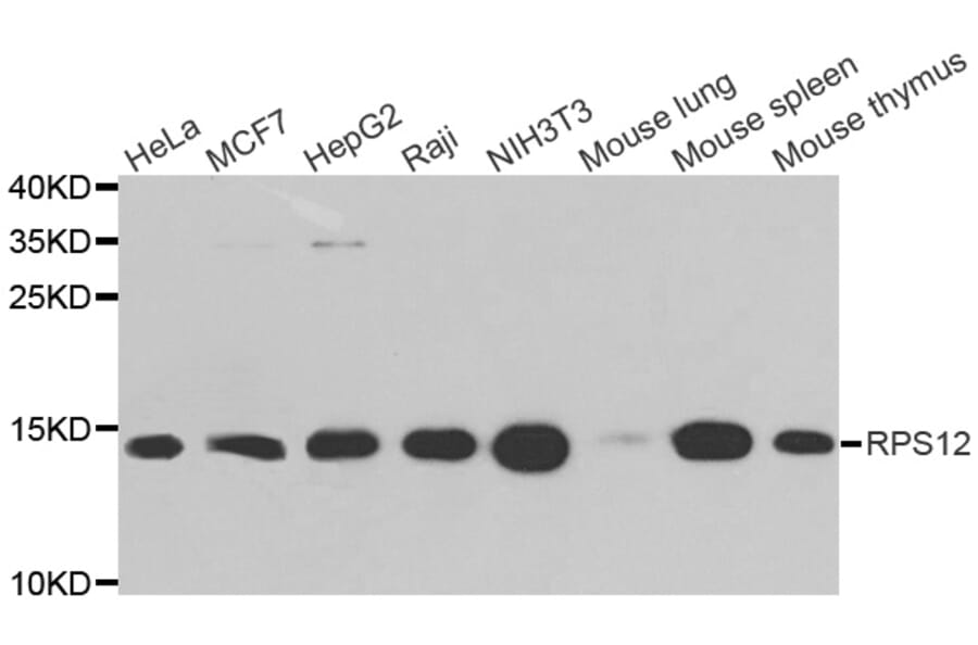 Western blot - RPS12 antibody from Signalway Antibody (38711) - Antibodies.com