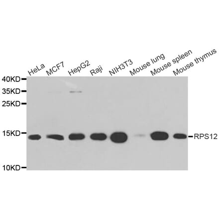 Western blot - RPS12 antibody from Signalway Antibody (38711) - Antibodies.com