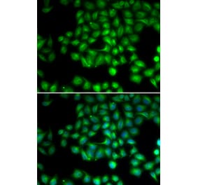 Immunofluorescence - TRPM2 antibody from Signalway Antibody (38727) - Antibodies.com