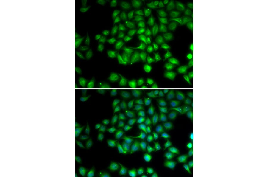 Immunofluorescence - TRPM2 antibody from Signalway Antibody (38727) - Antibodies.com