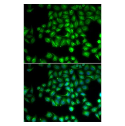 Immunofluorescence - TRPM2 antibody from Signalway Antibody (38727) - Antibodies.com