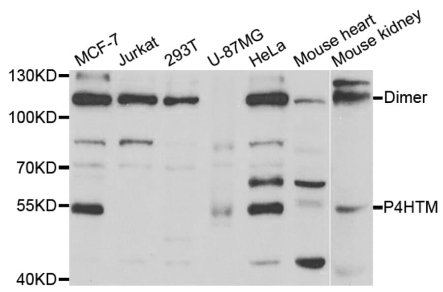 Western blot - P4HTM antibody from Signalway Antibody (38732) - Antibodies.com