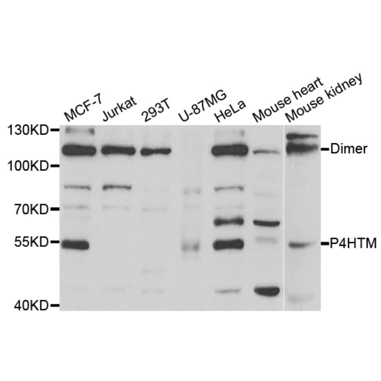Western blot - P4HTM antibody from Signalway Antibody (38732) - Antibodies.com
