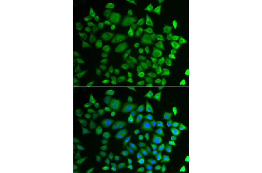 Immunofluorescence - P4HTM antibody from Signalway Antibody (38732) - Antibodies.com
