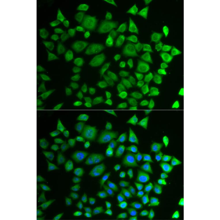 Immunofluorescence - P4HTM antibody from Signalway Antibody (38732) - Antibodies.com
