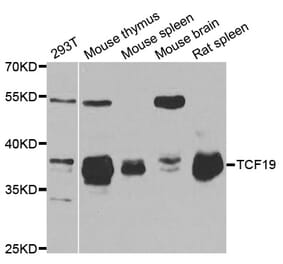 Western blot - TCF19 antibody from Signalway Antibody (38734) - Antibodies.com