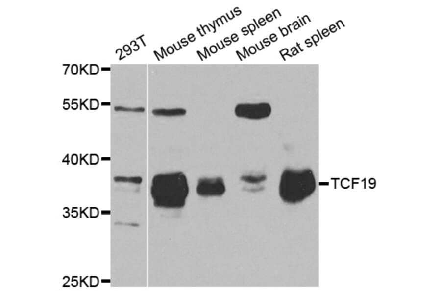 Western blot - TCF19 antibody from Signalway Antibody (38734) - Antibodies.com