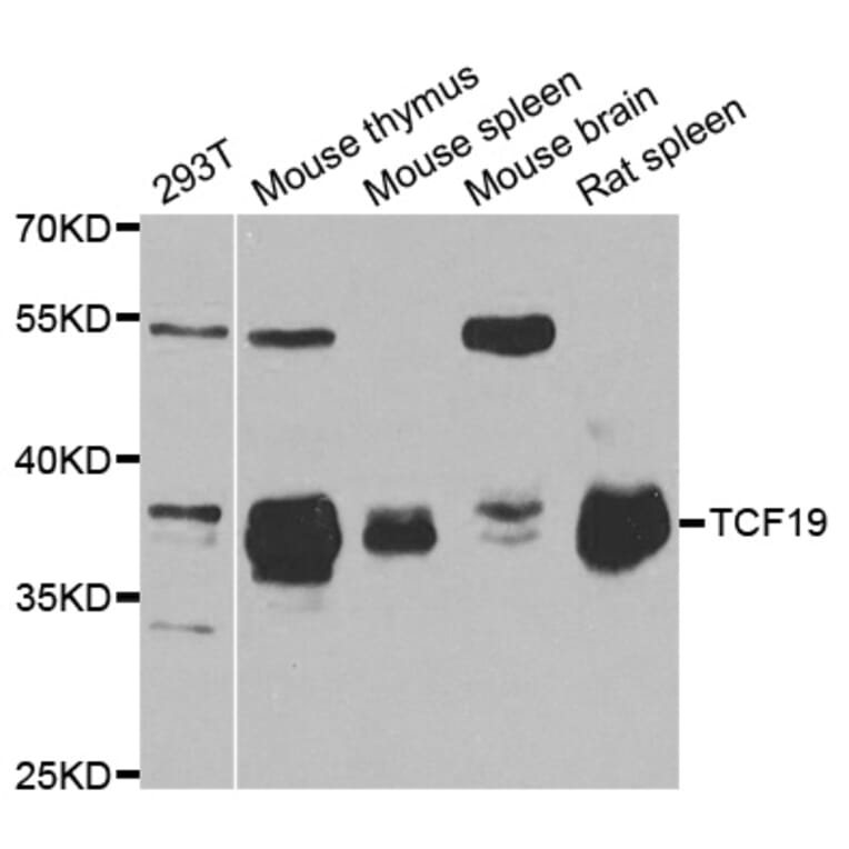 Western blot - TCF19 antibody from Signalway Antibody (38734) - Antibodies.com