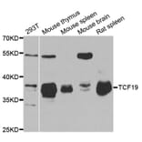 Western blot - TCF19 antibody from Signalway Antibody (38734) - Antibodies.com