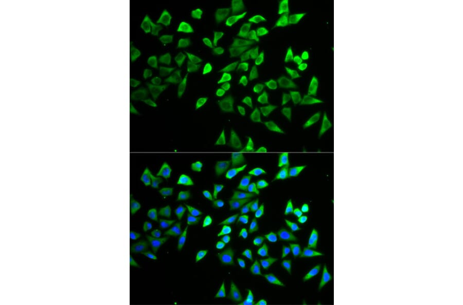 Immunofluorescence - TCF19 antibody from Signalway Antibody (38734) - Antibodies.com