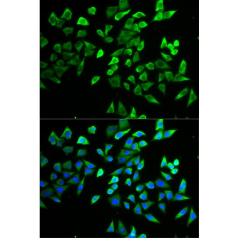 Immunofluorescence - TCF19 antibody from Signalway Antibody (38734) - Antibodies.com