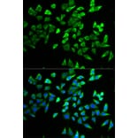 Immunofluorescence - TCF19 antibody from Signalway Antibody (38734) - Antibodies.com