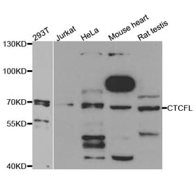 Western blot - CTCFL antibody from Signalway Antibody (38735) - Antibodies.com