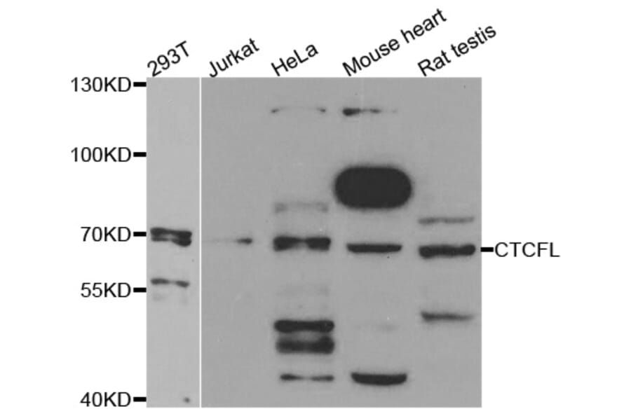 Western blot - CTCFL antibody from Signalway Antibody (38735) - Antibodies.com