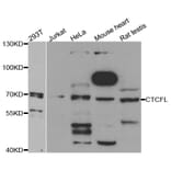 Western blot - CTCFL antibody from Signalway Antibody (38735) - Antibodies.com