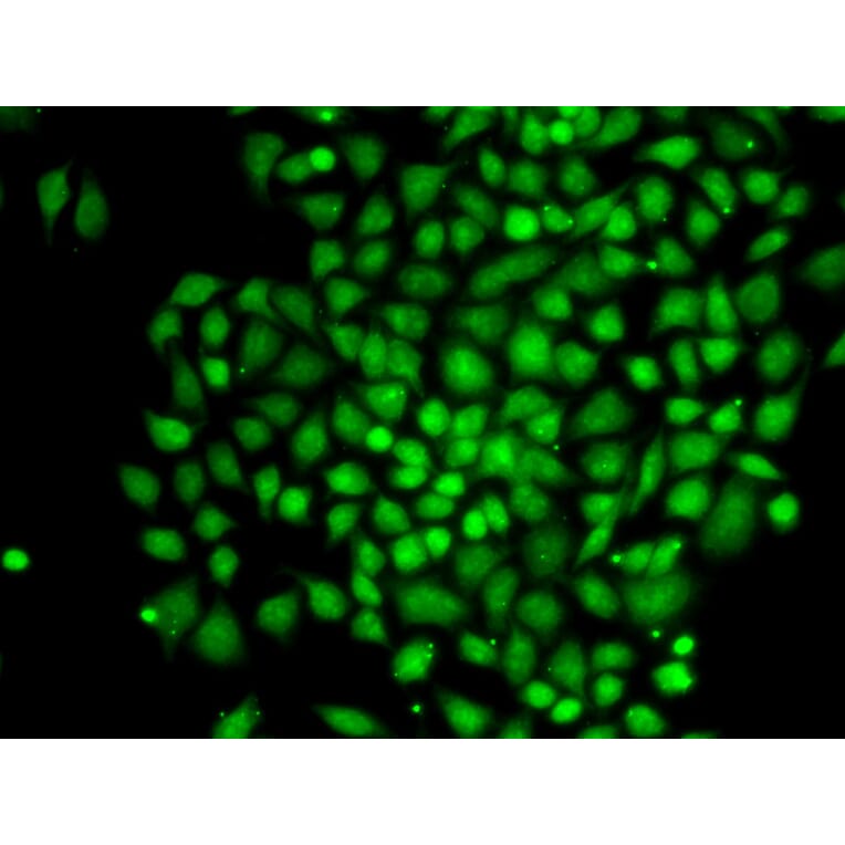 Immunofluorescence - CTCFL antibody from Signalway Antibody (38735) - Antibodies.com