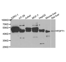 Western blot - FDFT1 antibody from Signalway Antibody (38762) - Antibodies.com