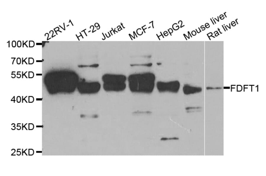 Western blot - FDFT1 antibody from Signalway Antibody (38762) - Antibodies.com