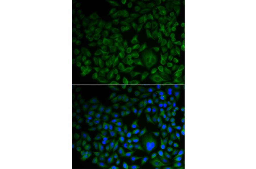 Immunofluorescence - FDFT1 antibody from Signalway Antibody (38762) - Antibodies.com