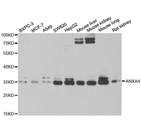 Western blot - ANXA4 antibody from Signalway Antibody (38790) - Antibodies.com