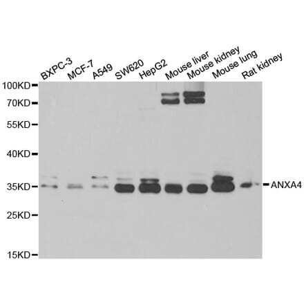 Western blot - ANXA4 antibody from Signalway Antibody (38790) - Antibodies.com