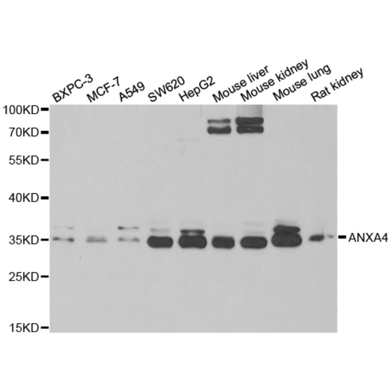 Western blot - ANXA4 antibody from Signalway Antibody (38790) - Antibodies.com