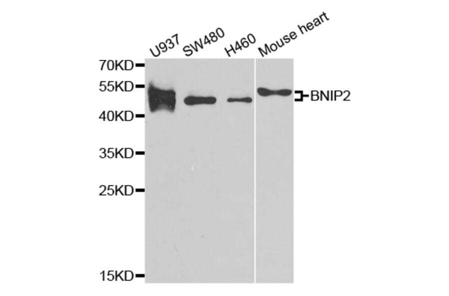 Western blot - BNIP2 antibody from Signalway Antibody (38791) - Antibodies.com