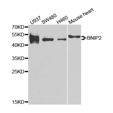 Western blot - BNIP2 antibody from Signalway Antibody (38791) - Antibodies.com