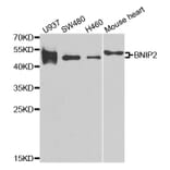 Western blot - BNIP2 antibody from Signalway Antibody (38791) - Antibodies.com