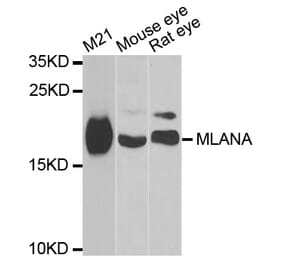 Western blot - MLANA antibody from Signalway Antibody (38798) - Antibodies.com