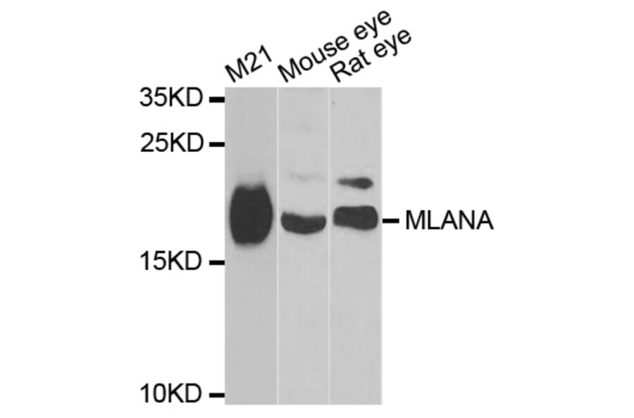 Western blot - MLANA antibody from Signalway Antibody (38798) - Antibodies.com
