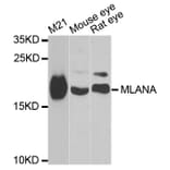 Western blot - MLANA antibody from Signalway Antibody (38798) - Antibodies.com