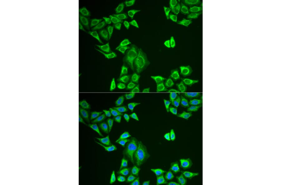 Immunofluorescence - MLANA antibody from Signalway Antibody (38798) - Antibodies.com