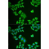 Immunofluorescence - MLANA antibody from Signalway Antibody (38798) - Antibodies.com