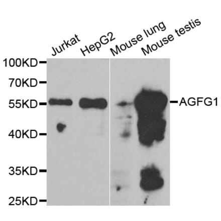 Western blot - AGFG1 antibody from Signalway Antibody (38801) - Antibodies.com