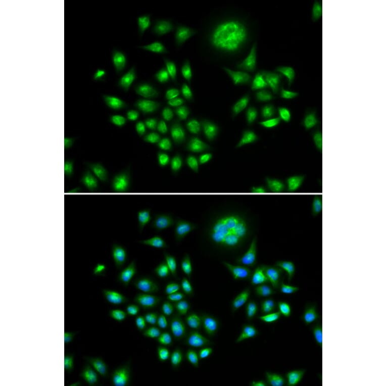 Immunofluorescence - AGFG1 antibody from Signalway Antibody (38801) - Antibodies.com