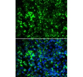 Immunofluorescence - KCNA2 antibody from Signalway Antibody (38802) - Antibodies.com