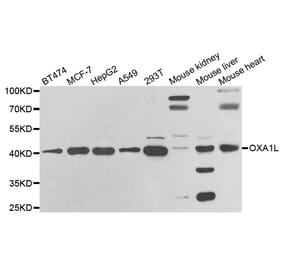 Western blot - OXA1L antibody from Signalway Antibody (38806) - Antibodies.com